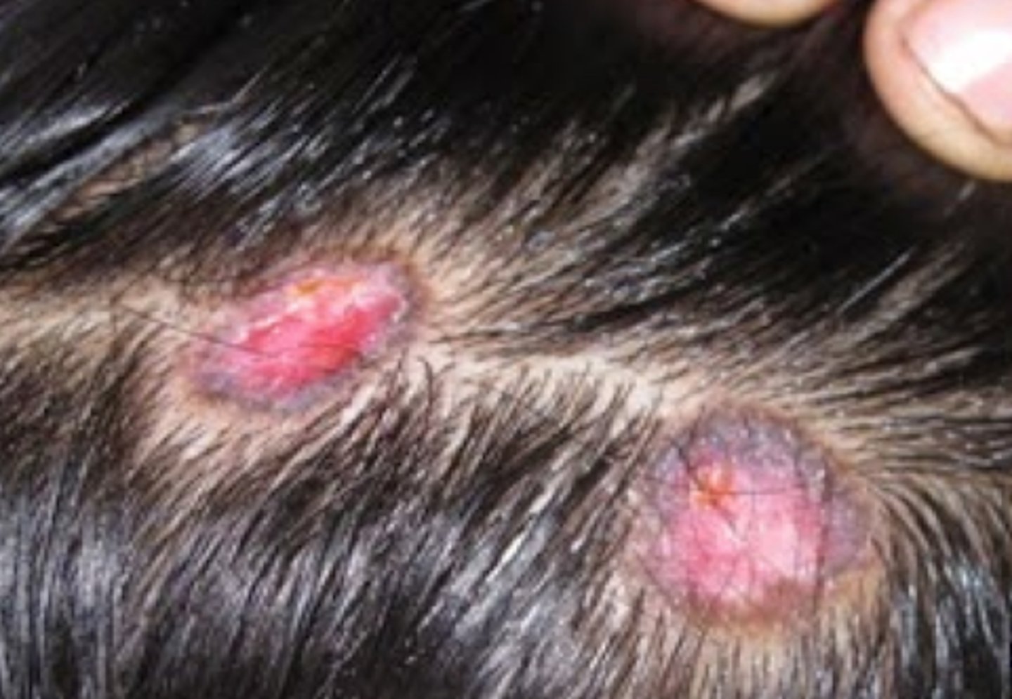<p>What is the diagnosis?</p>