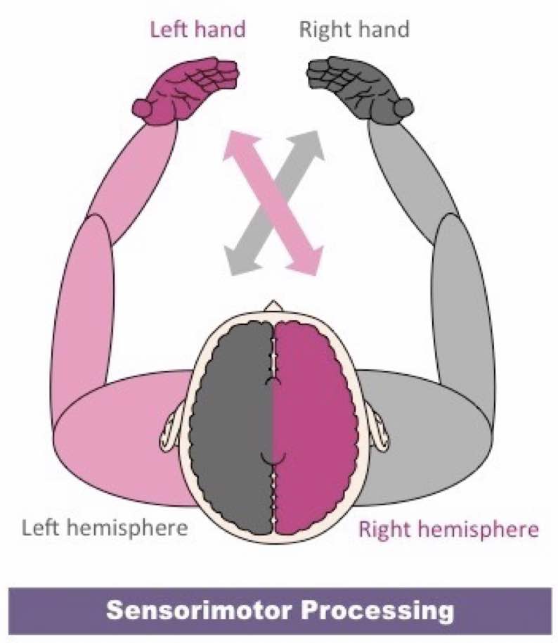 <p>Right Cerebral Hemisphere</p>