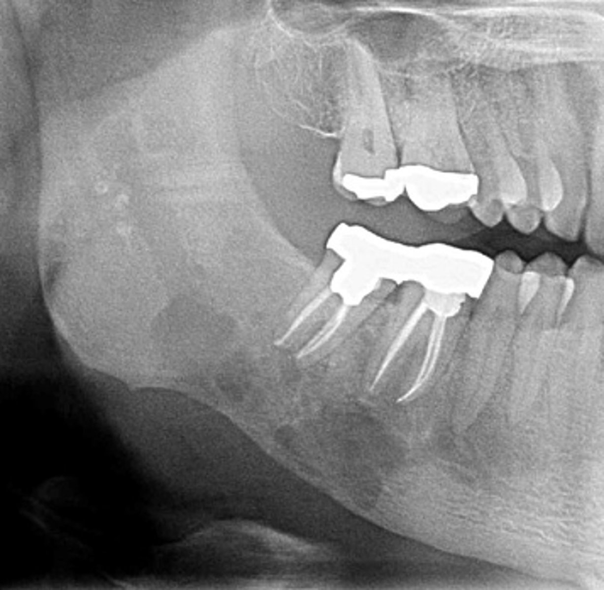 <p>describe the periphery of this lesion:</p>