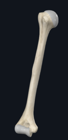 <p>Is this a right or left humerus?</p>