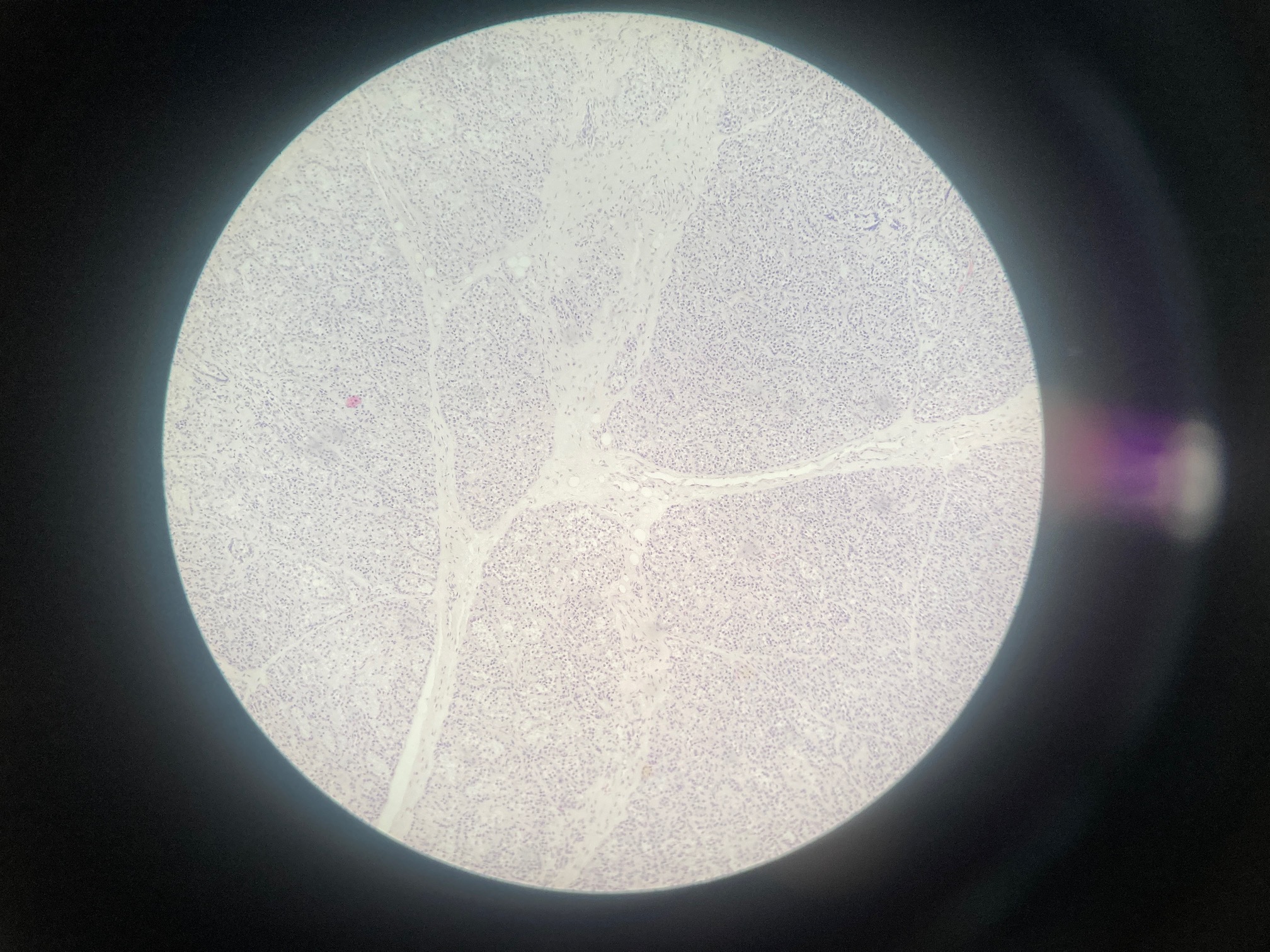 <p>Lactating mammary gland</p><p>Myoepithelial cells</p>