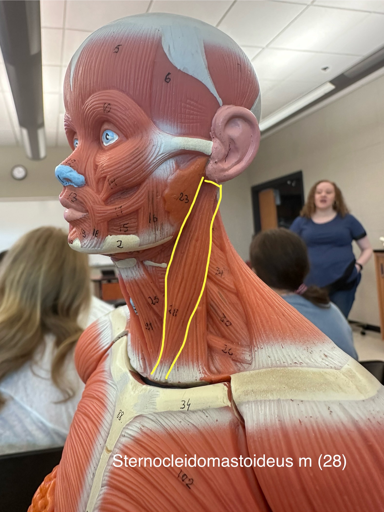 <p>Sternocleidomastoid muscle. This muscle flexes and laterally rotates the head.</p>