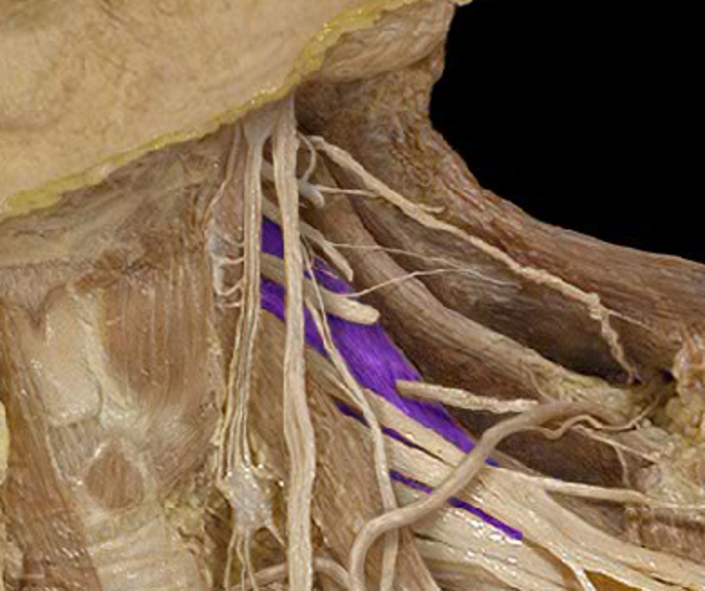 <p>Name the Muscle</p>