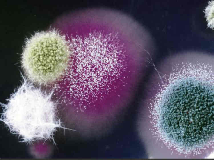 <p>It looks like a growth on the top side and underside may be a different colour. </p>