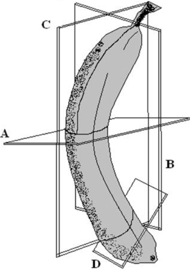 <p>a cut at an angle between the other planes, D</p>