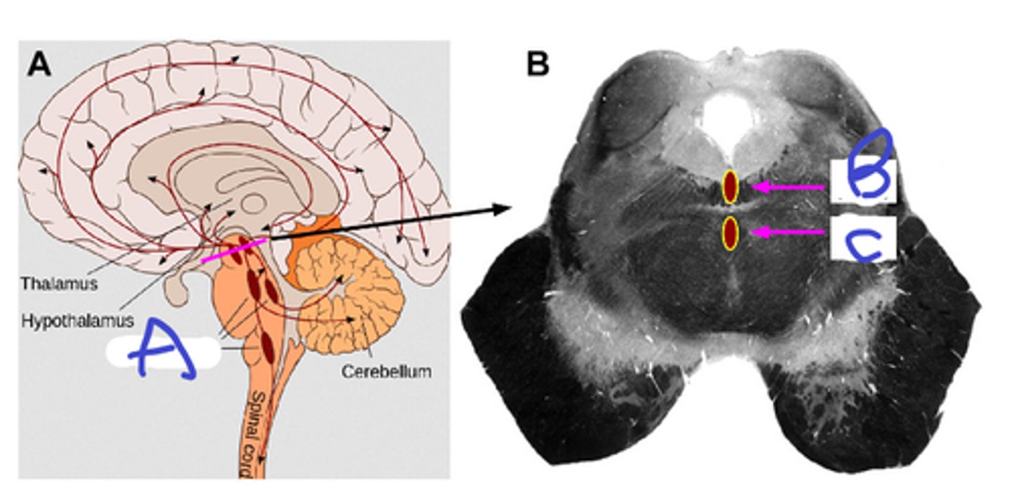 <p>A</p><p>extra credit: B, C</p><p>notice where axons terminate</p>