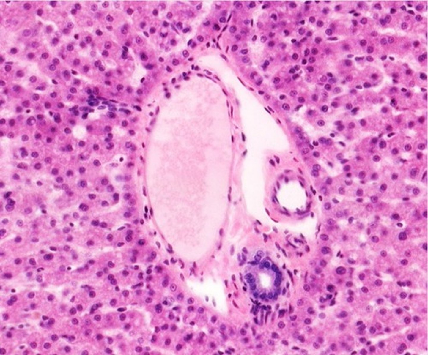 <p>branches of hepatic artery, hepatic portal vein, and bile duct</p>