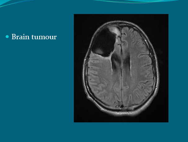 <p>Patient preparation </p>