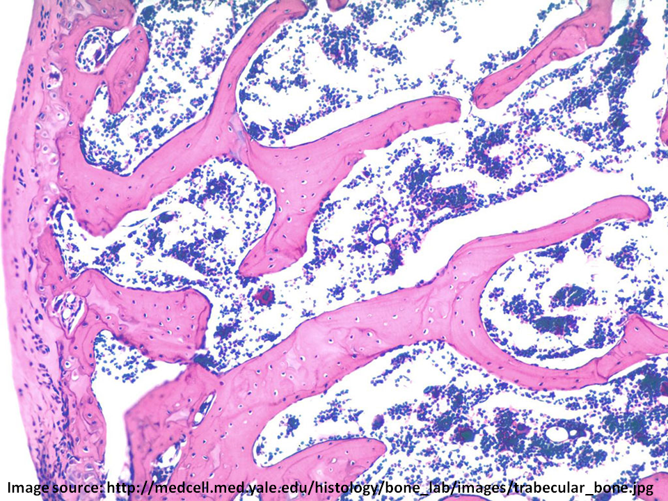 <p>type of bone structure:</p><ul><li><p>aka Cancellous Bone</p></li><li><p>Sponge-like meshwork consisting of trabeculae</p></li><li><p>spaces are continuous &amp; occupied by yellow bone marrow &amp; blood vessels</p></li></ul>