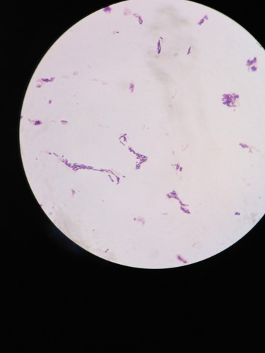 Identify the gram reaction and shape