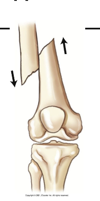 <p>What apposition is this?</p>