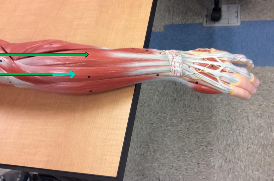 <p>Identify this muscle?</p>