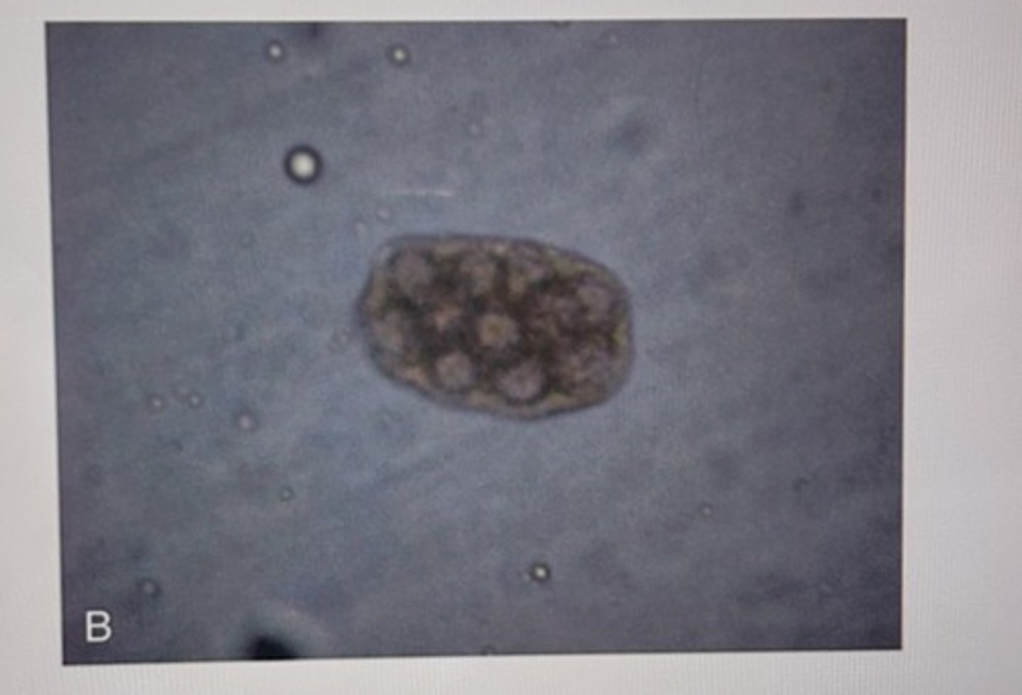 <p>This Cestode ovum contains many hexacanths within one egg packet. This type of Cestode ovum is called...</p>