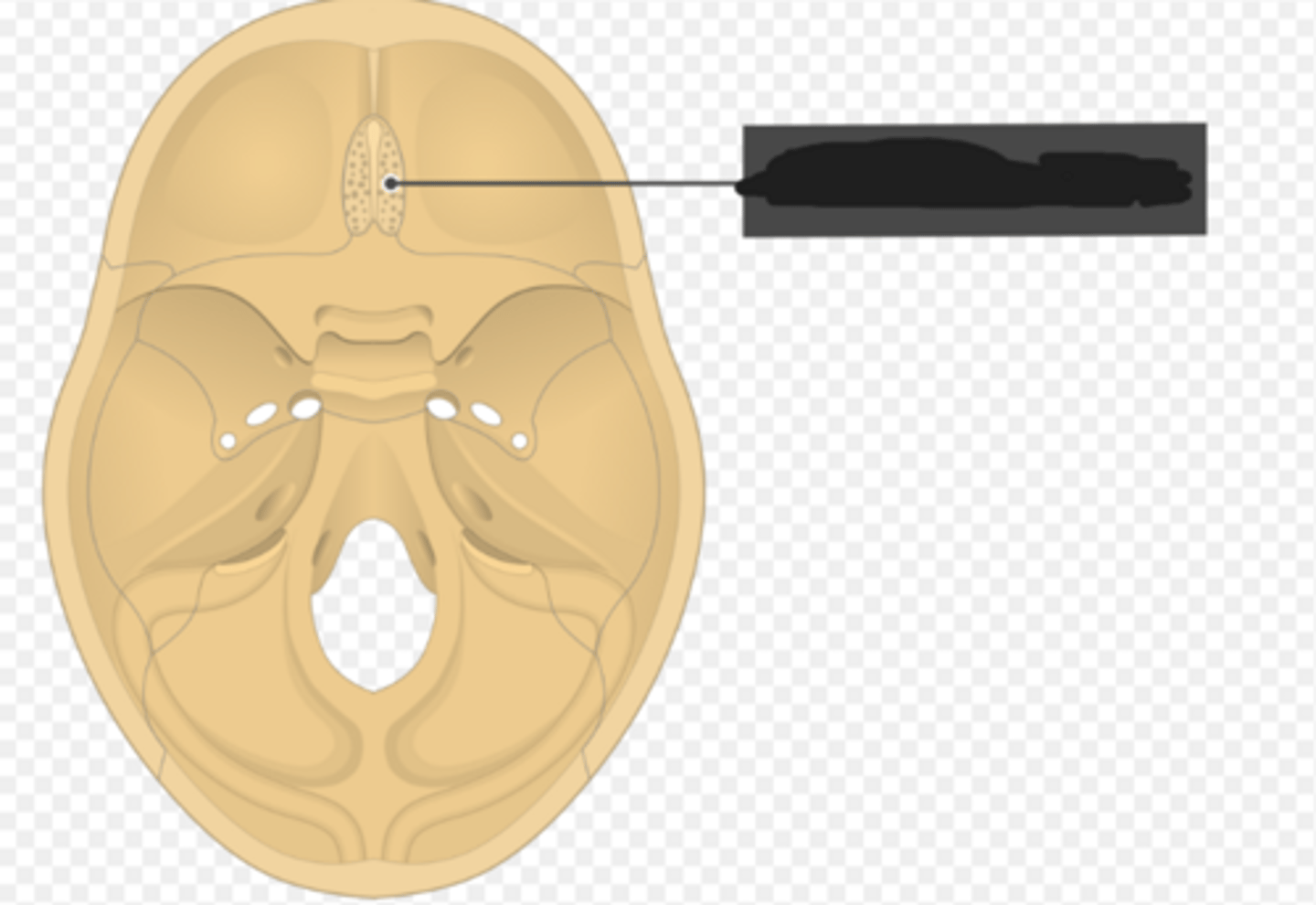 <p>Cribriform plate of the ethmoid bone</p>