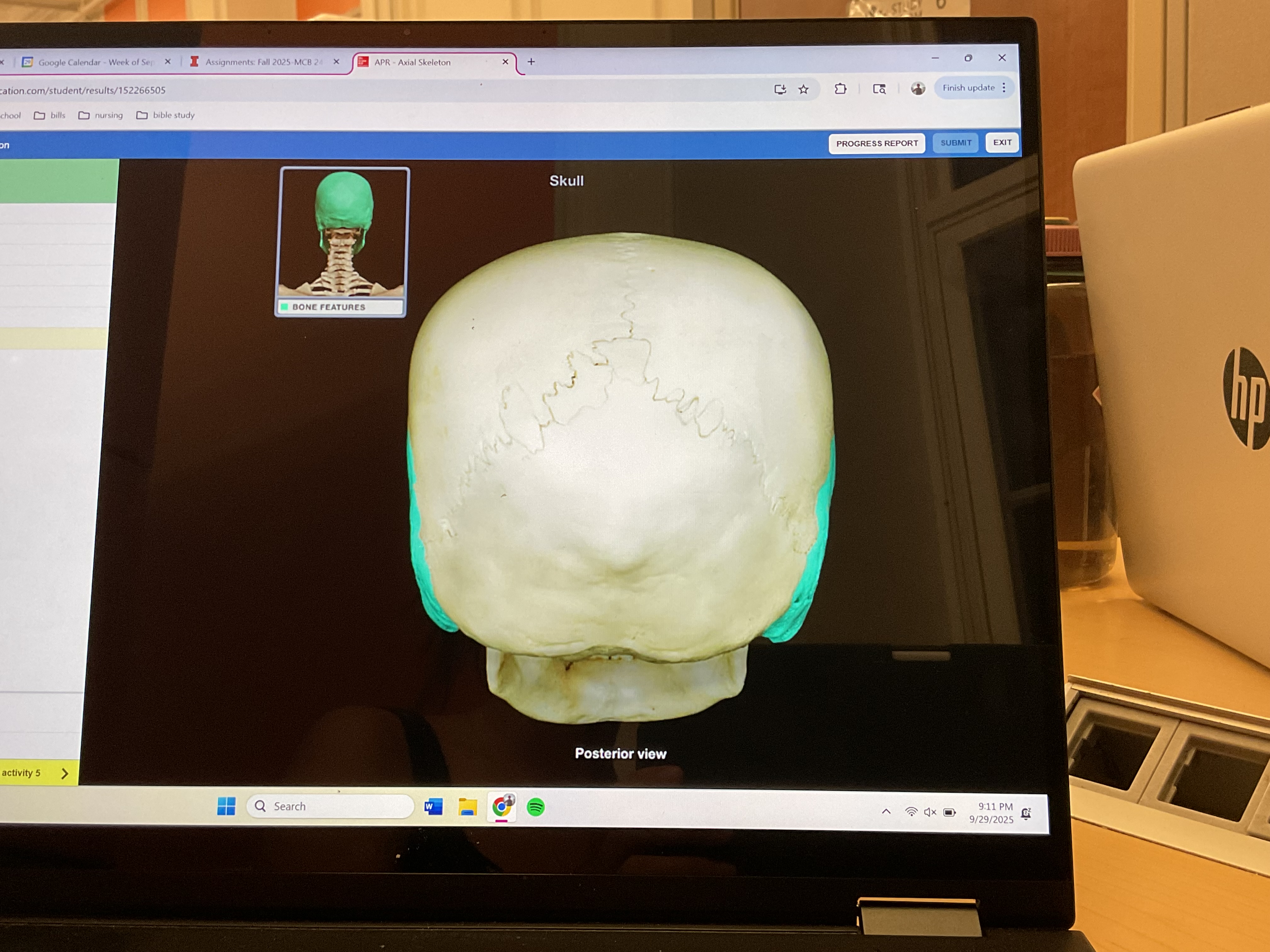 <p>Temporal bone </p>