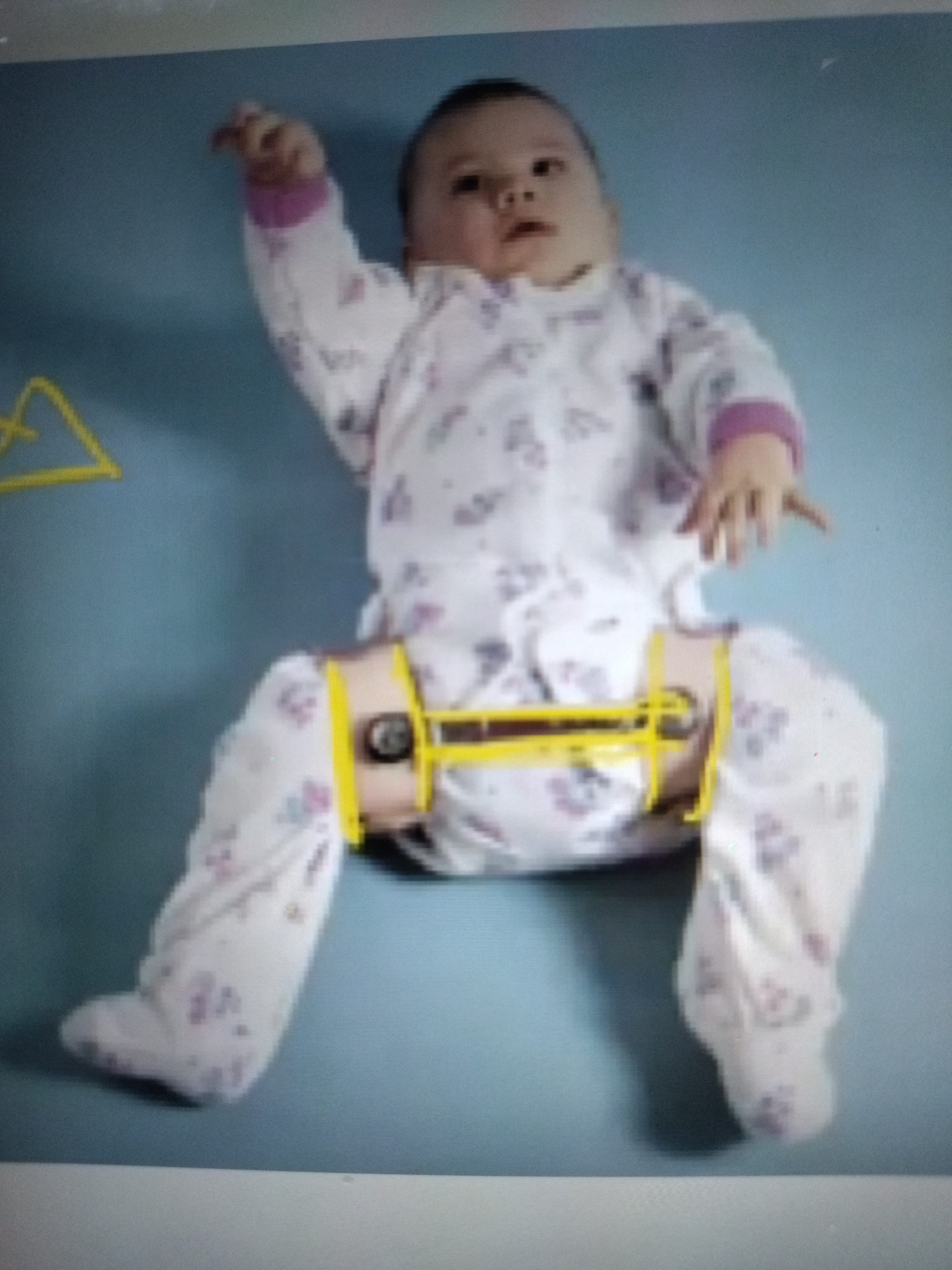 Only has bilateral thigh bands connected by a crossbar