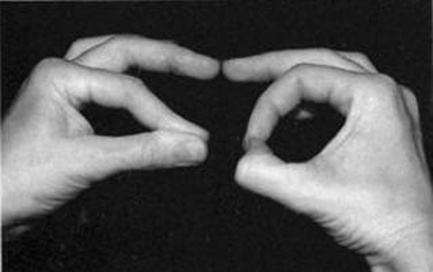 <p>Ask the patient to put the tip of their thumb to the tip of their index finger.</p><p>Positive: if they put the pads of their thumb and forefinger together -> Ant. Interosseous N. Syndrome -> Median N. Lesion</p>