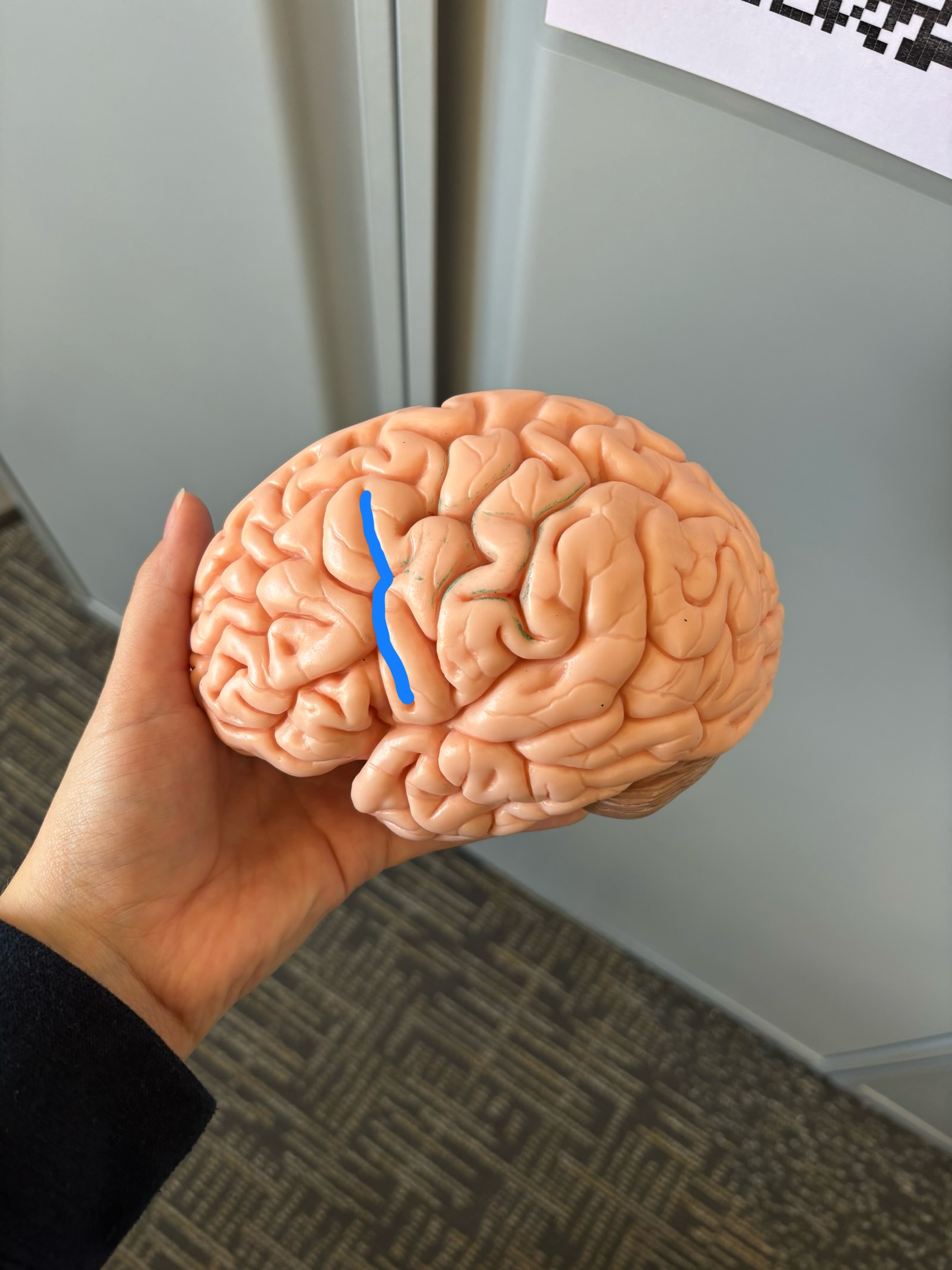 <p>Precentral Sulcus</p>