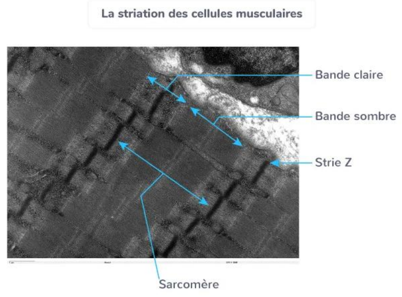 <p><span style="background-color: transparent;"><strong><span>La jonction neuromusculaire et le système musculo-articulaire</span></strong></span></p><p><span style="background-color: transparent;"><strong><span>Les sarcomères : unité fonctionnelle de contraction</span></strong></span></p><p><span style="background-color: transparent;"><span>Le </span><strong><span>sarcomère</span></strong><span> est l’unité contractile fondamentale du muscle strié.<br> Il est constitué de :</span></span></p><ul><li><p><span style="background-color: transparent;"><strong><span>filaments fins d’actine</span></strong><span>,</span></span></p></li><li><p><span style="background-color: transparent;"><strong><span>filaments épais de myosine</span></strong><span>,</span></span></p></li><li><p><span style="background-color: transparent;"><span>et de </span><strong><span>protéines régulatrices</span></strong><span> (troponine, tropomyosine).</span></span></p></li></ul><p><span style="background-color: transparent;"><span>Lors de la contraction, les filaments d’actine glissent entre les filaments de myosine, provoquant le </span><strong><span>raccourcissement du sarcomère</span></strong><span> et donc la </span><strong><span>contraction du muscle</span></strong><span>.<br> La succession de ces sarcomères le long des myofibrilles explique l’aspect strié du muscle squelettique.</span></span></p>