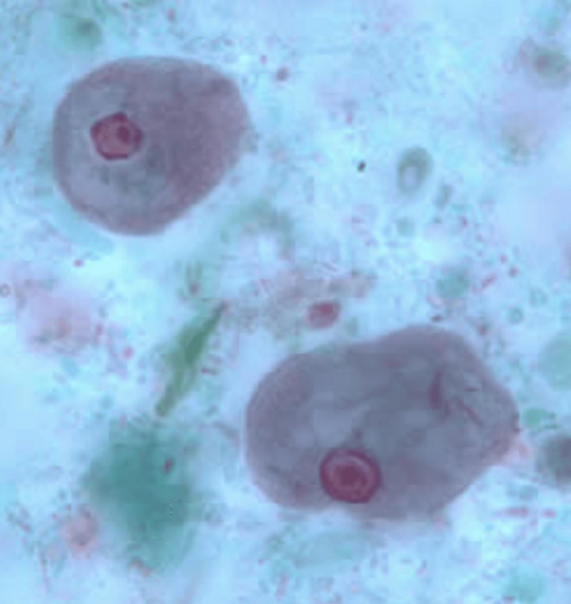 knowt flashcard image