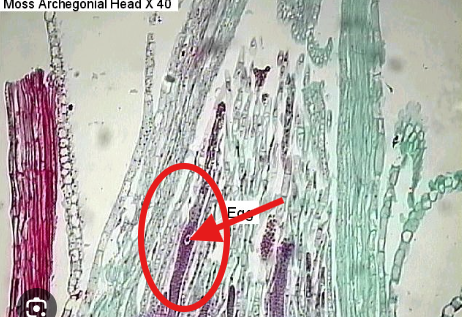 <p>Which part of the Archegonial Head is the arrow pointing to?</p>