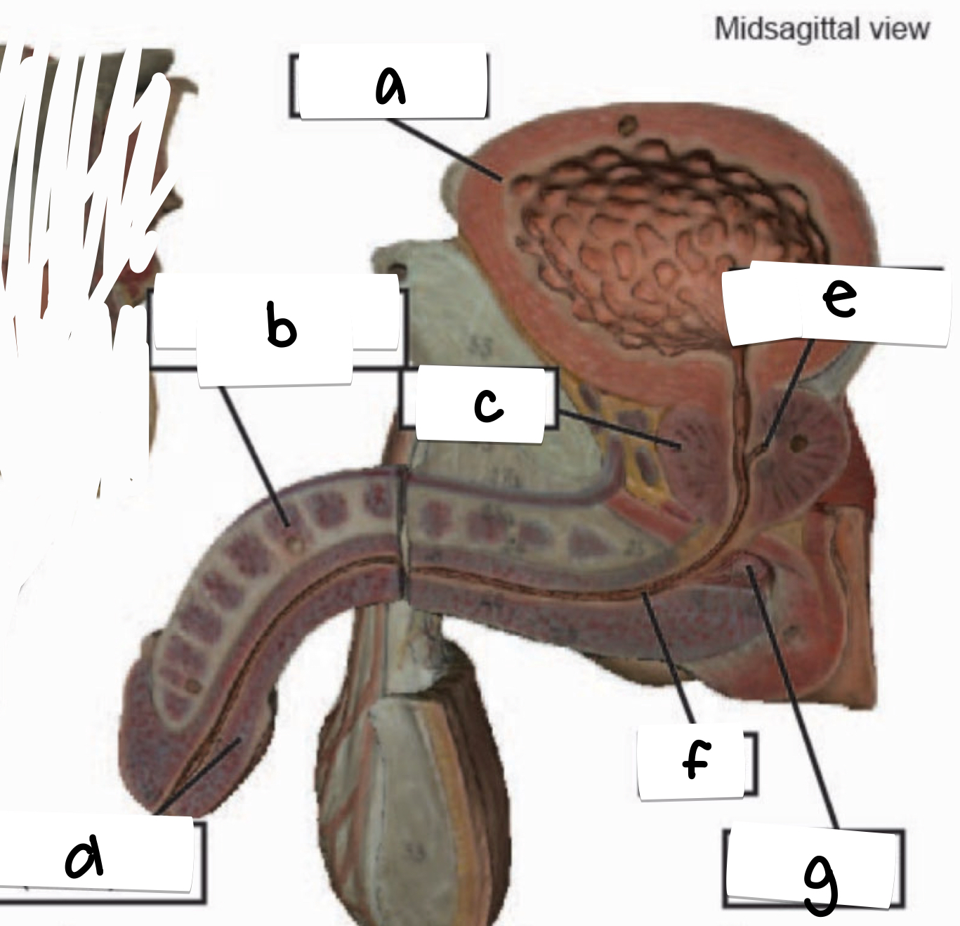 <p>what is labeled f on this male reproductive model midsagittal view?</p>