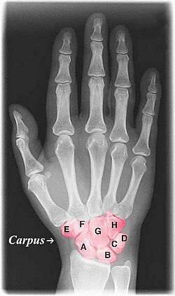 <p>Trapezoid (dorsal view of right wrist)</p>