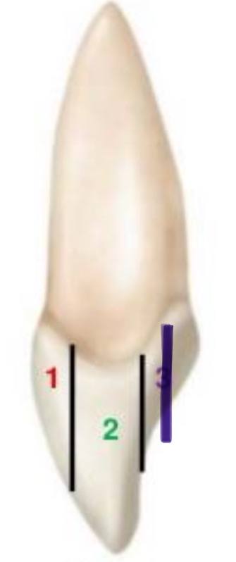 <p>what division is this in the facio-lingually (crown)</p>