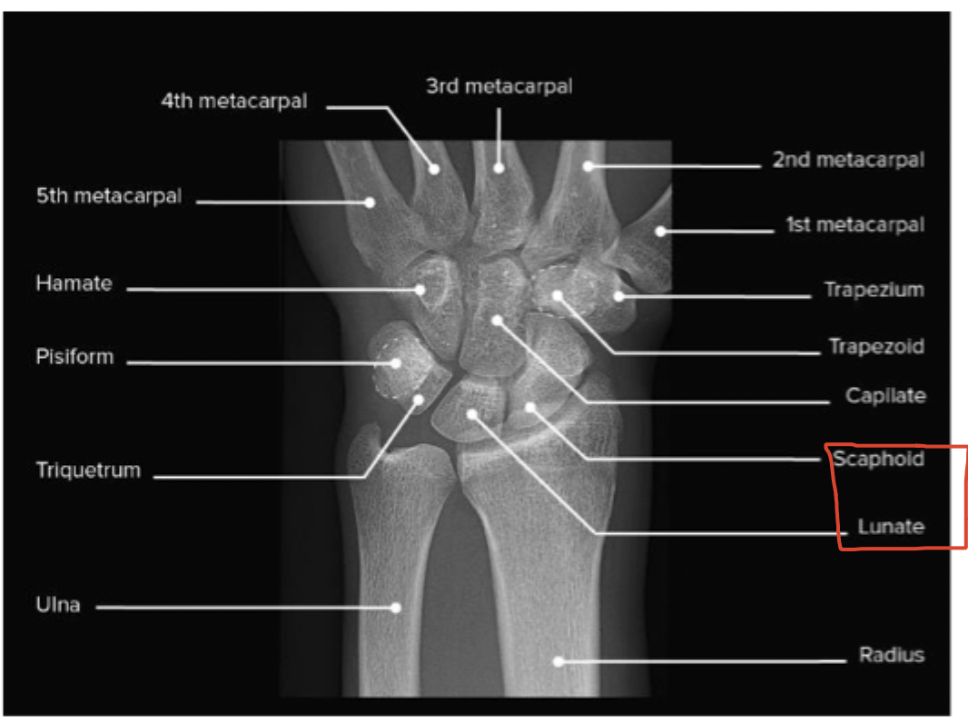 <p>normal wrist</p>
