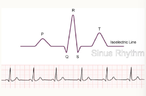 <ul><li><p>the normal rhythm of the heart</p></li></ul><p></p>