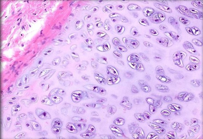 <p>A type of cartilage characterized by a glassy appearance and a high content of collagen fibers, providing support with some flexibility. It is commonly found in joints, ribs, and the nose. </p>
