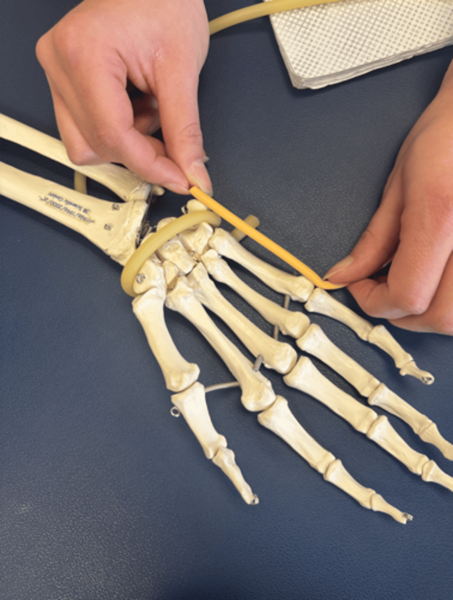 <p>What is this muscle?</p>