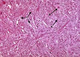 <p>What tissue is this</p>