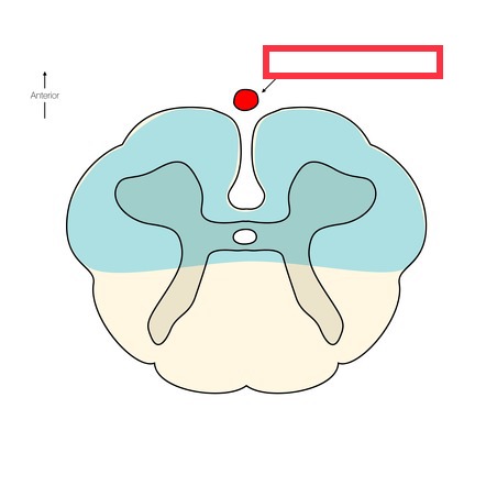 blood vessel from the merged branches of the vertebral arteries that runs along the anterior surface of the spinal cord