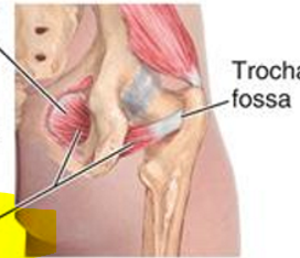 <p>What muscle is this?</p>