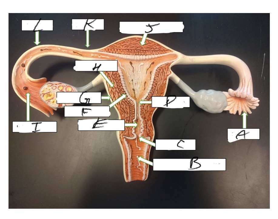 <p>What is structure G</p>