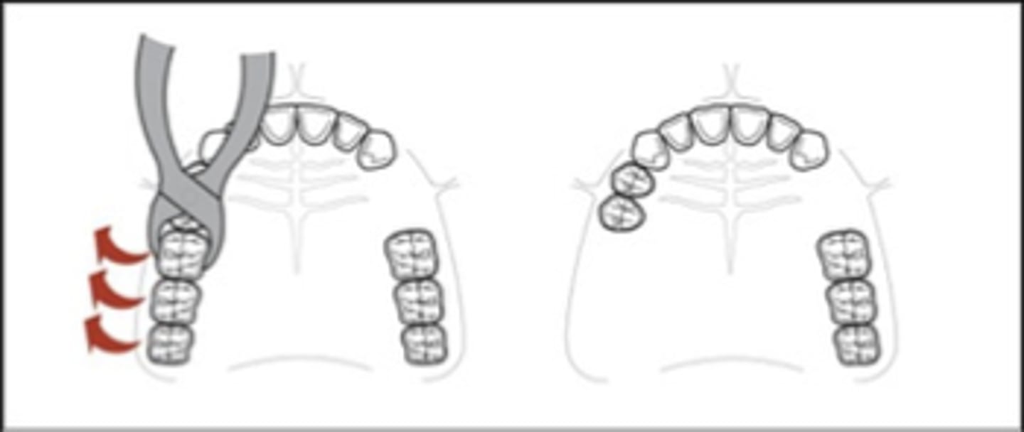 <p>Applegate’s Rules:</p><p>Rule 1. Classification should ______ rather than precede any ______ of teeth that might alter the original classification</p>