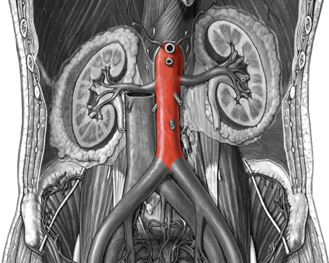 <p>Which arteries:</p><ul><li><p>Extends from descending aorta</p></li><li><p>Pass through diaphragm and into abdominal cavity</p></li></ul><p></p>