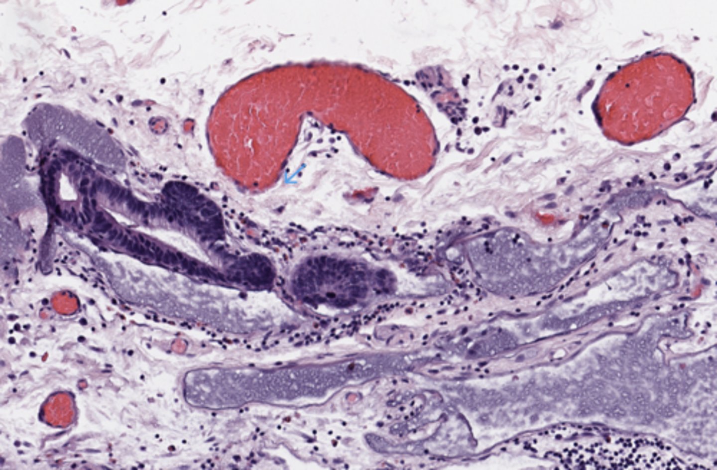 <p>Stomach</p>