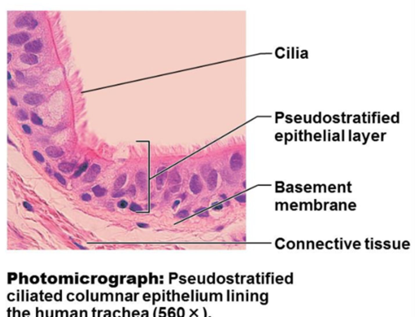 <p>- all cells rest on a basement membrane</p><p>- single layer, but some cells are shorter than others giving a false (pseudo) impression of stratification</p>