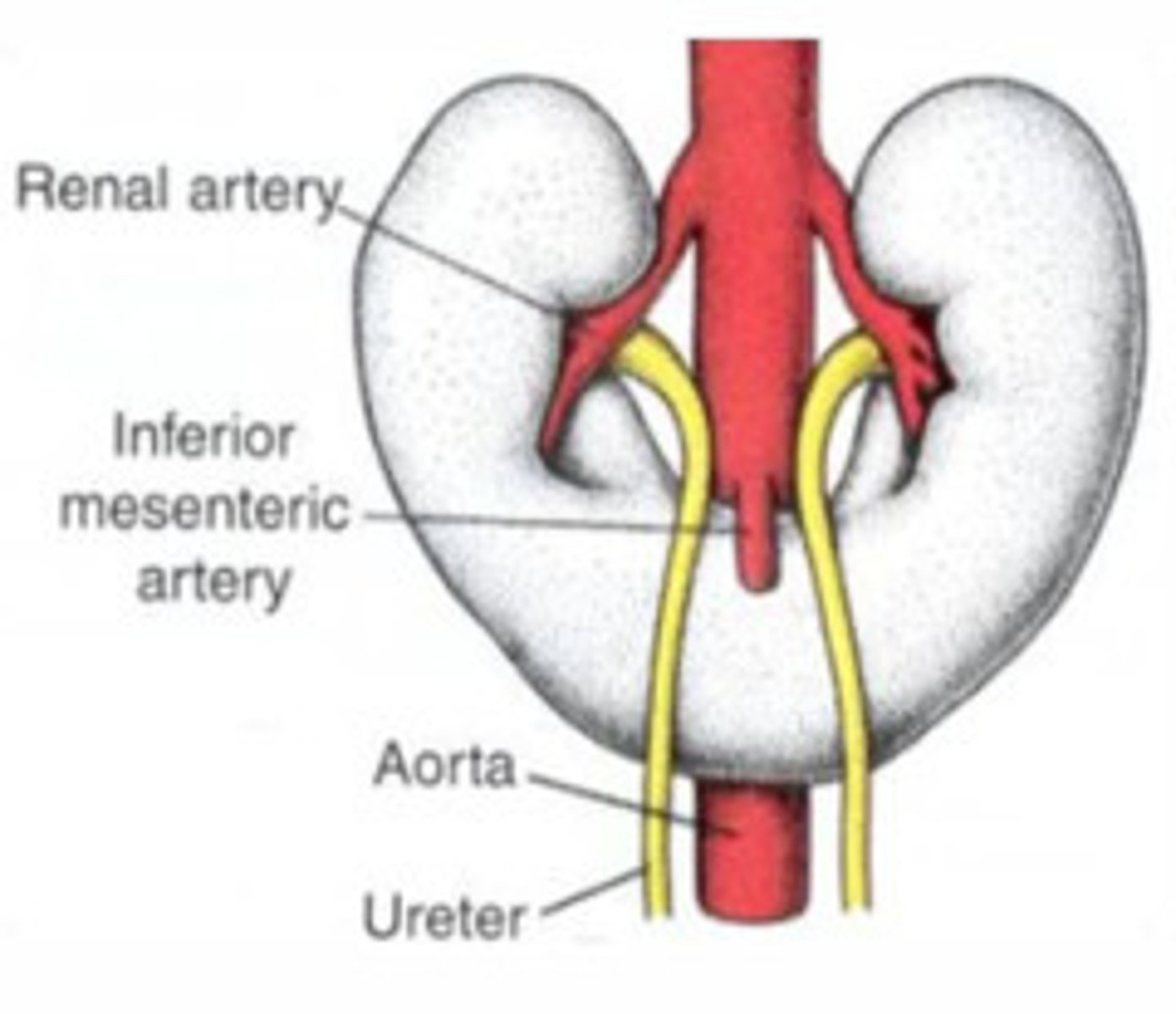 <p>malformations - e.g. horseshoe kidney</p>