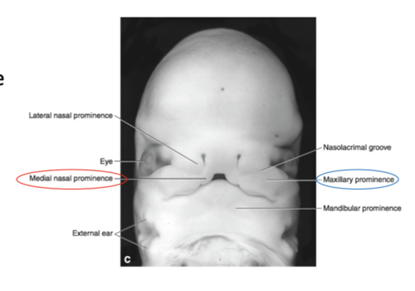 <p>The Medial nasal processes merge with each other to form? </p>
