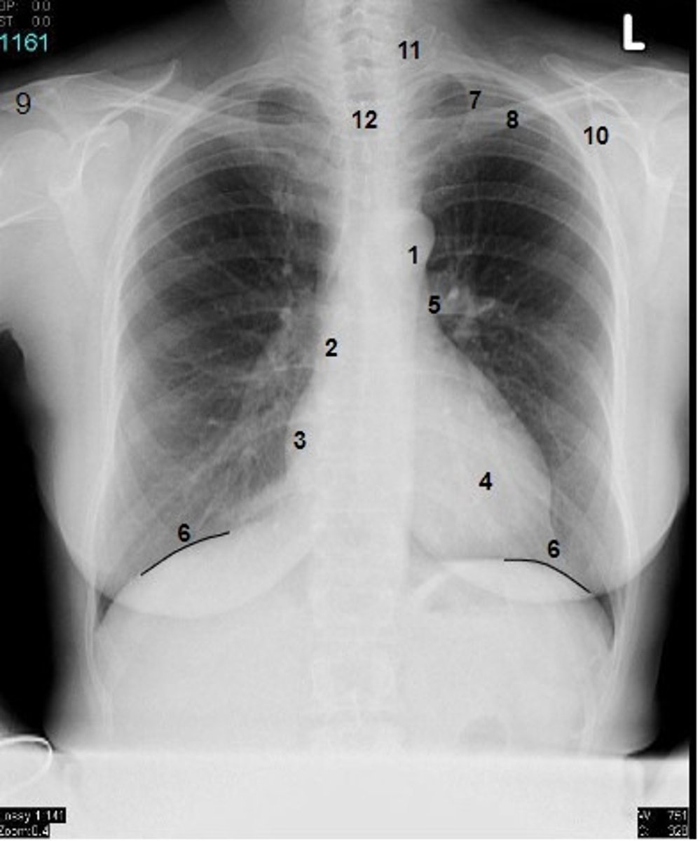 <p>at what number is the acromion of scapula</p>