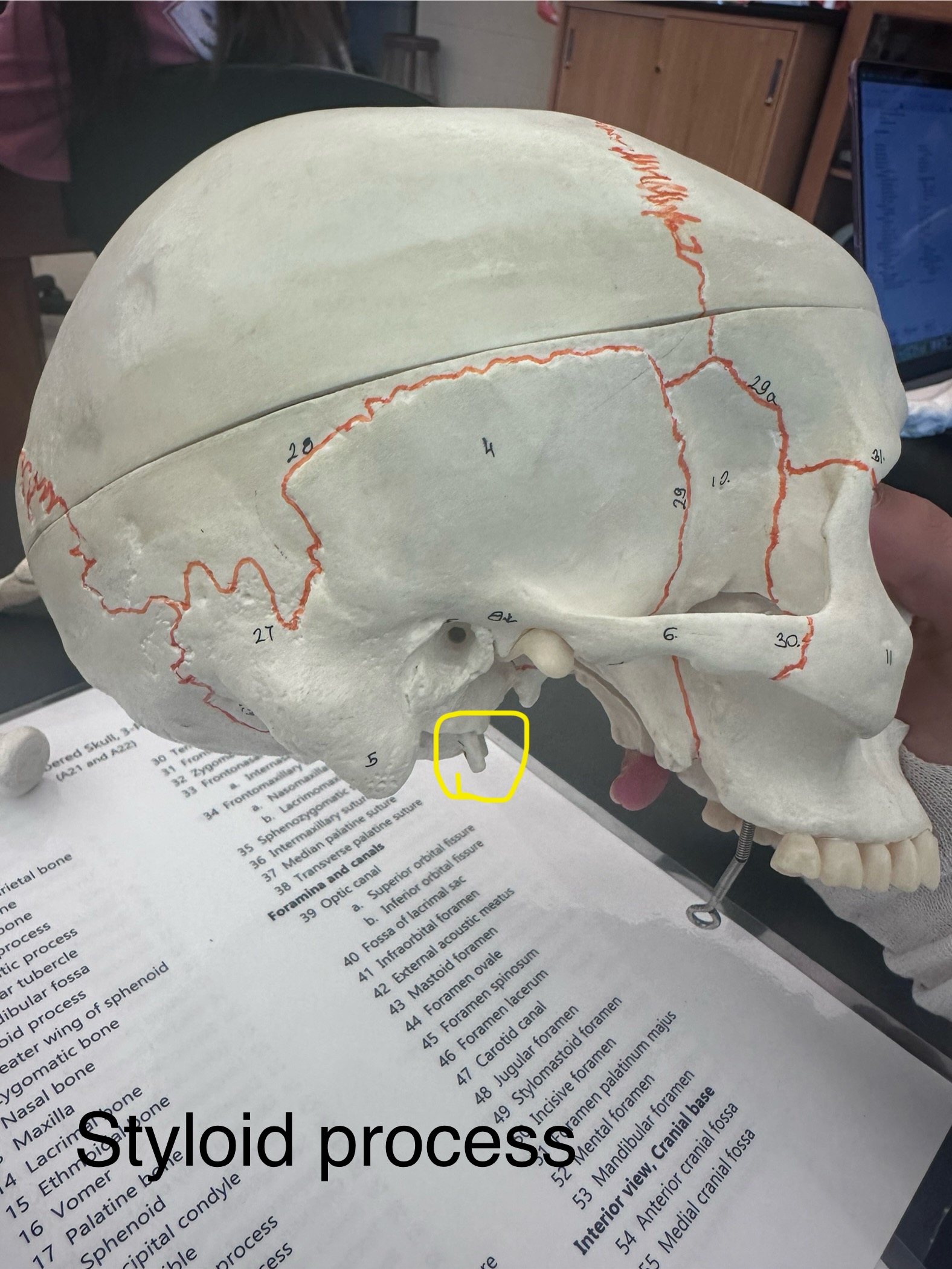 <p>Styloid Process</p>