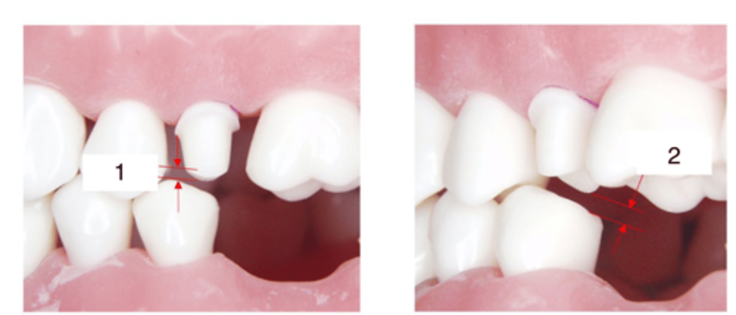 <p>What is the measurement of 1?</p>