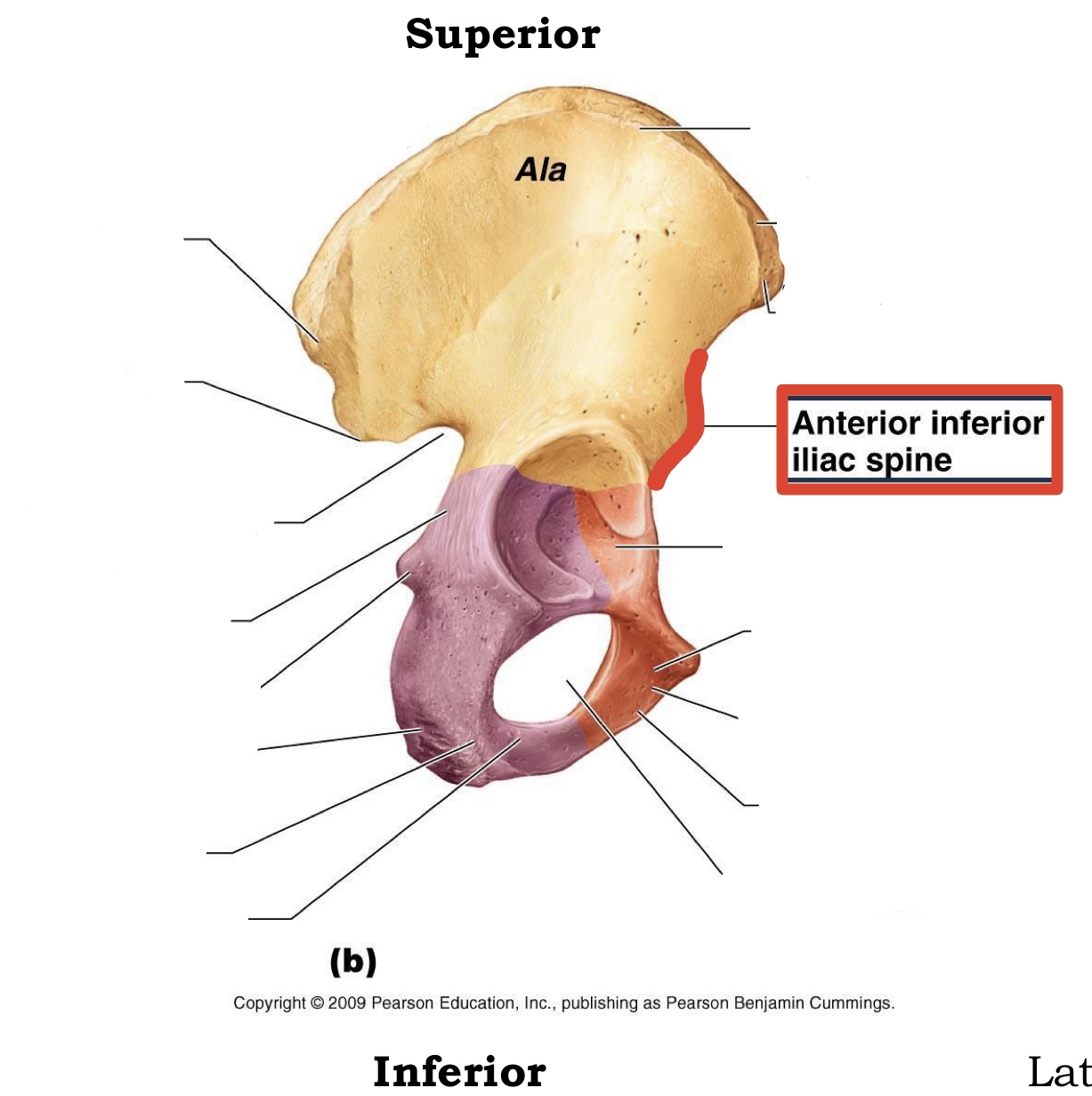 <p><span><span>Anterior inferior iliac spine</span></span></p>