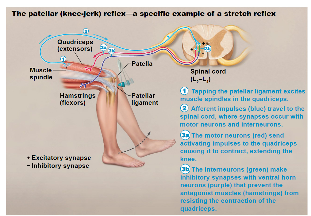 <ul><li><p>tapping the patellar ligament excites<br>muscle spindles in the quadriceps.</p></li><li><p>Afferent impulses (blue) travel to the<br>spinal cord, where synapses occur with<br>motor neurons and interneurons.</p></li><li><p>The motor neurons (red) send<br>activating impulses to the quadriceps<br>causing it to contract, extending the<br>knee.</p></li><li><p>The interneurons (green) make<br>inhibitory synapses with ventral horn<br>neurons (purple) that prevent the<br>antagonist muscles (hamstrings) from<br>resisting the contraction of the<br>quadriceps</p></li></ul>