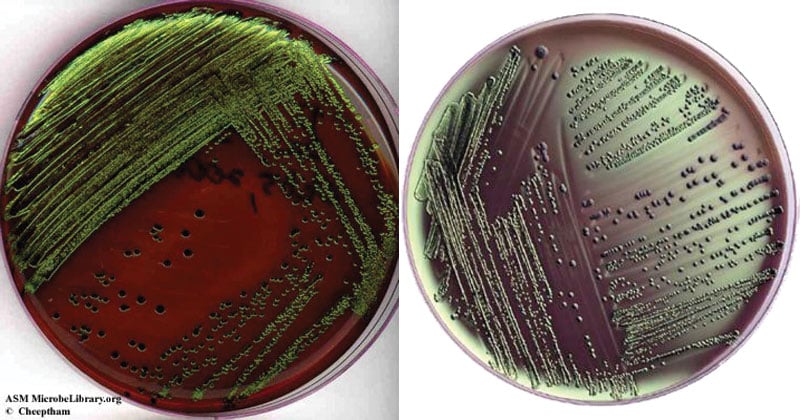 <p>Selective = G-, Eosin Y &amp; Methylene Blue </p><p>Differential = Rate of lactose Fermentation, lactose &amp; dyes</p><p>Vigorous fermenter = metallic green sheen</p><p>Slow fermenter = grow pink </p><p>No fermentation = no color change</p>