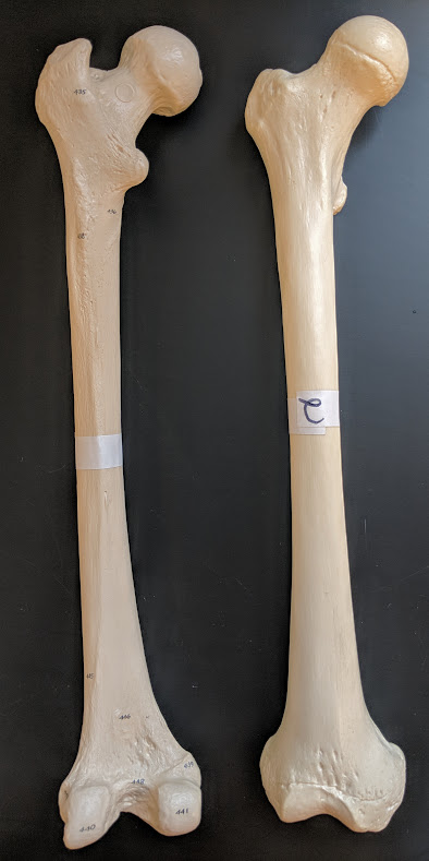 <p>Name this bone</p>