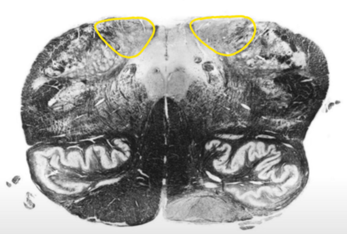 <p>ID the nucleus</p>
